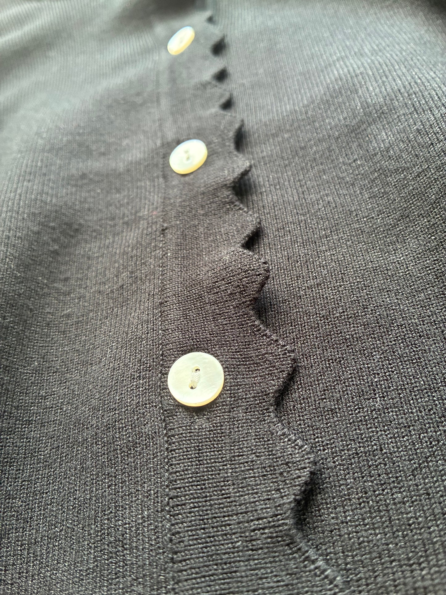 Scalloped Placket Cardigan